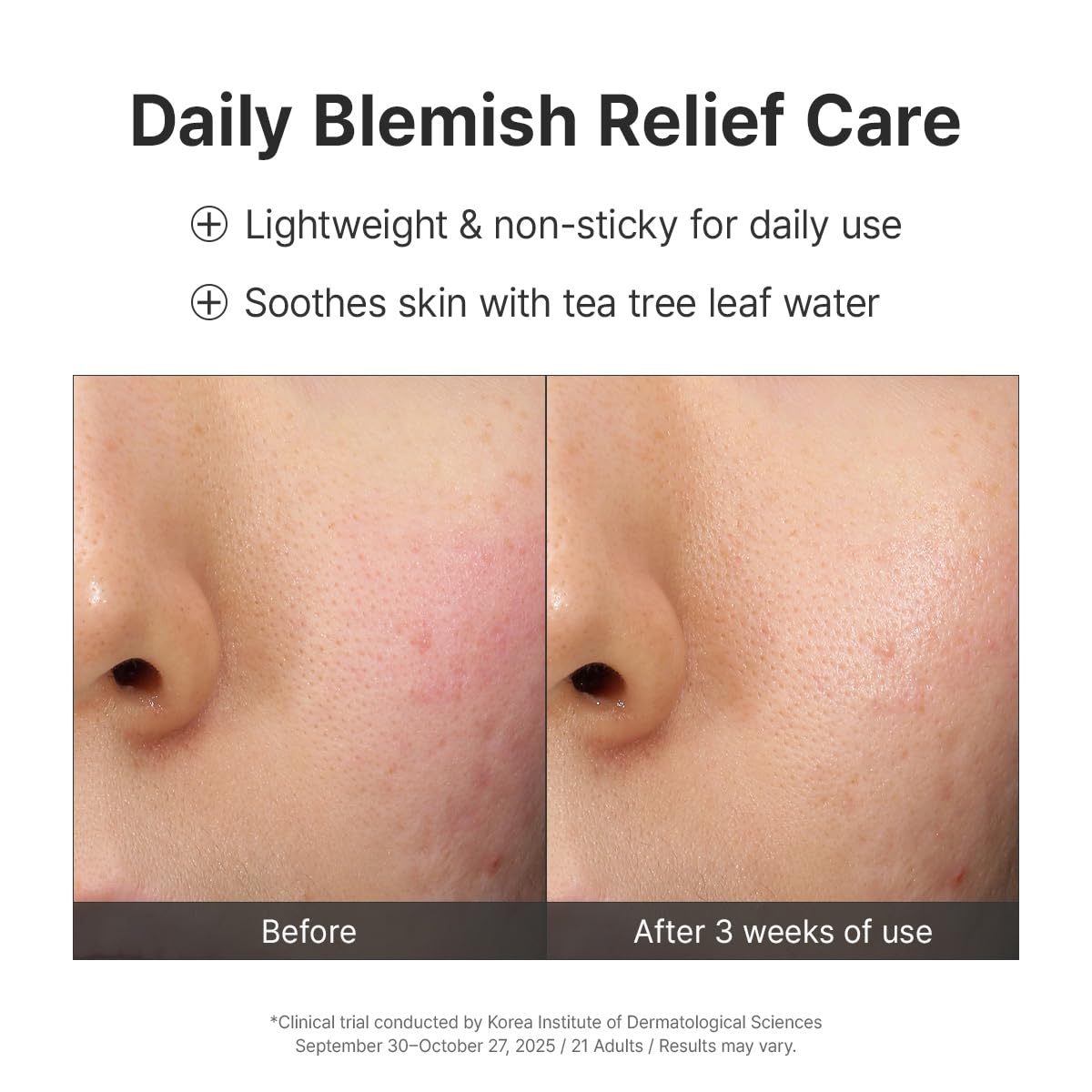 Dr.Althea 345 Relief Cream, 0.50 Fl Oz (Ver.2 - Pack of 1)