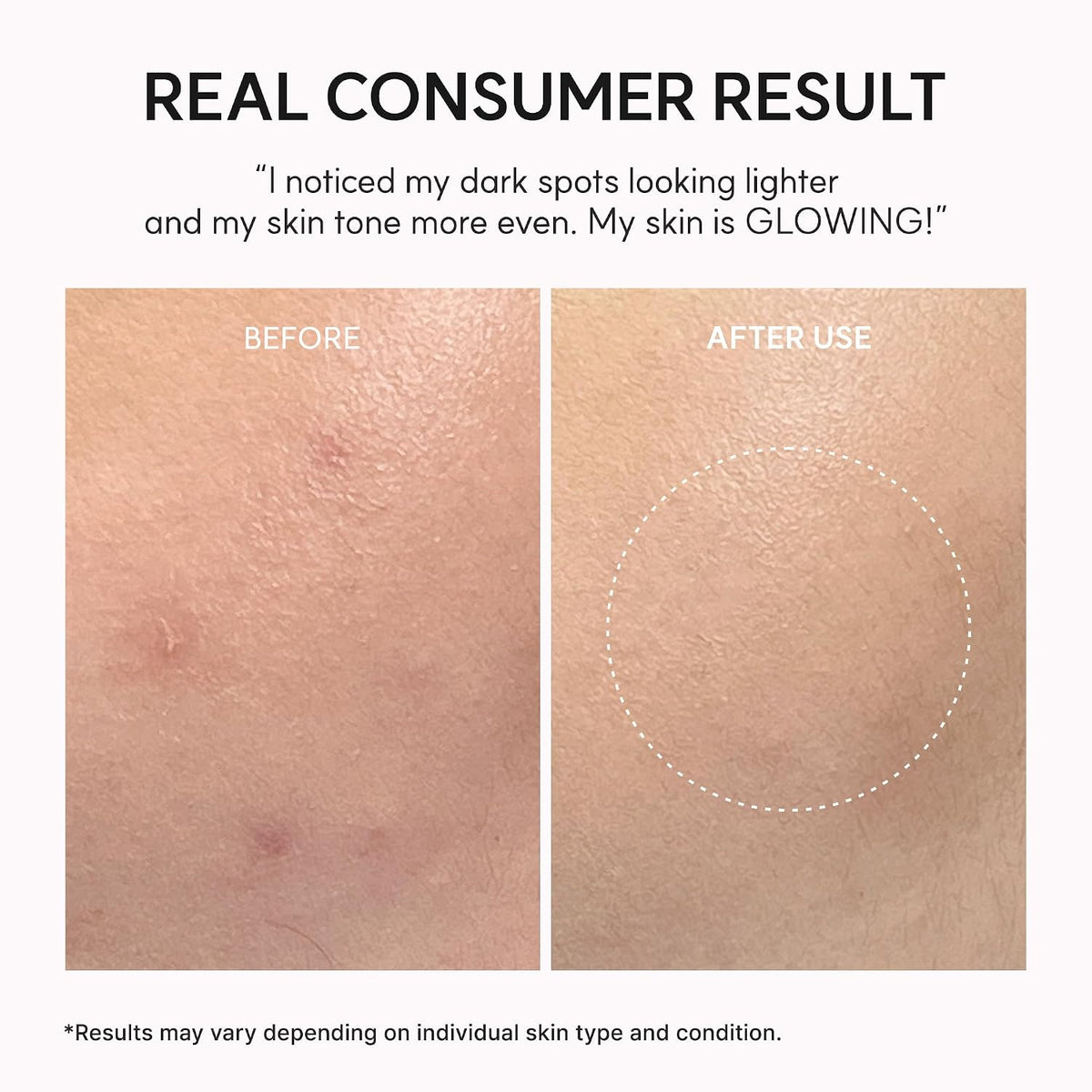 Arencia Vitamin C Booster Shot Serum with Glutathione, Niacinamide and Vitamin E for Dark Spot Care, Fine Lines & Wrinkles, Glass Skin, Korean Skincare 30ml/1.01 fl.oz