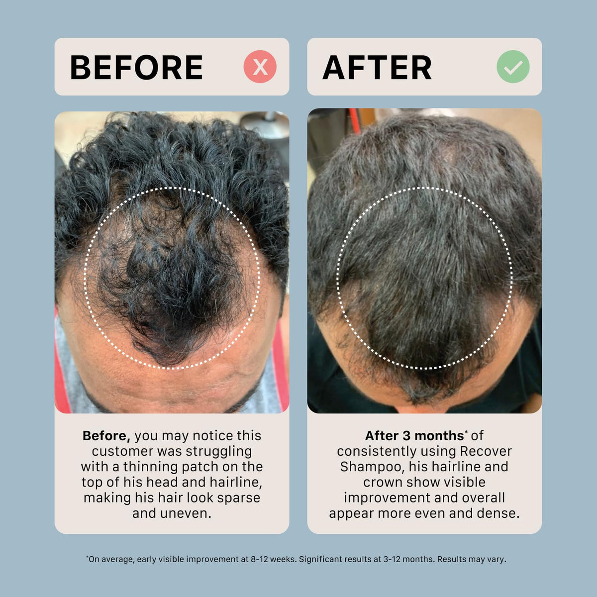 ACTIIV Recover Thickening Shampoo Treatment For Men | For Fuller Hair