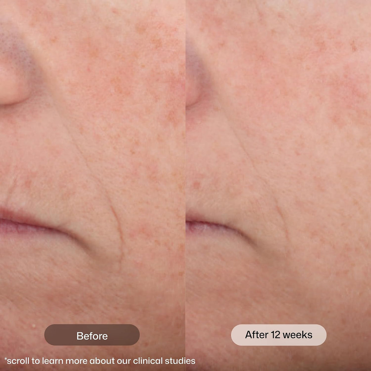 Revision Skincare Intellishade® Original SPF 45 Tinted Face Sunscreen