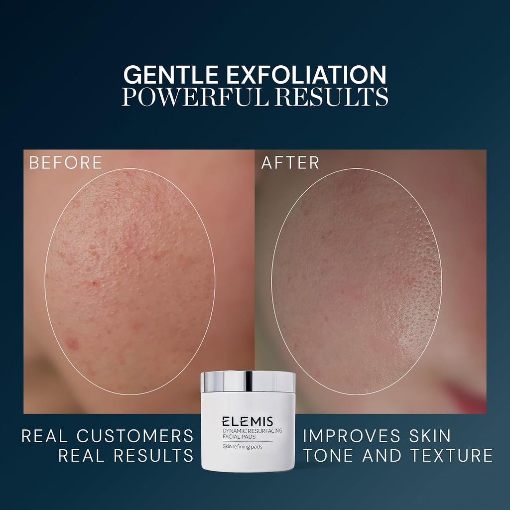 ELEMIS Dynamic Resurfacing Facial Pads, Gentle Textured Treatment