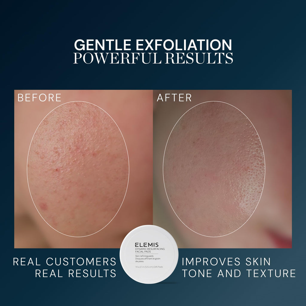ELEMIS Dynamic Resurfacing Facial Pads, Gentle Textured Treatment