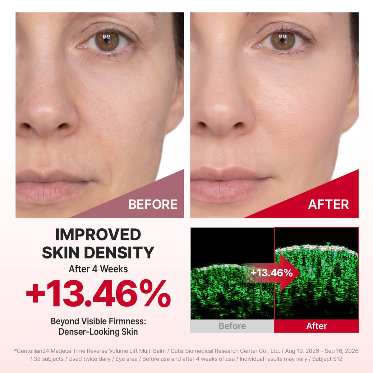 CENTELLIAN 24 Madeca Cream Time Reverse, TECA Anti-Aging Moisturizer