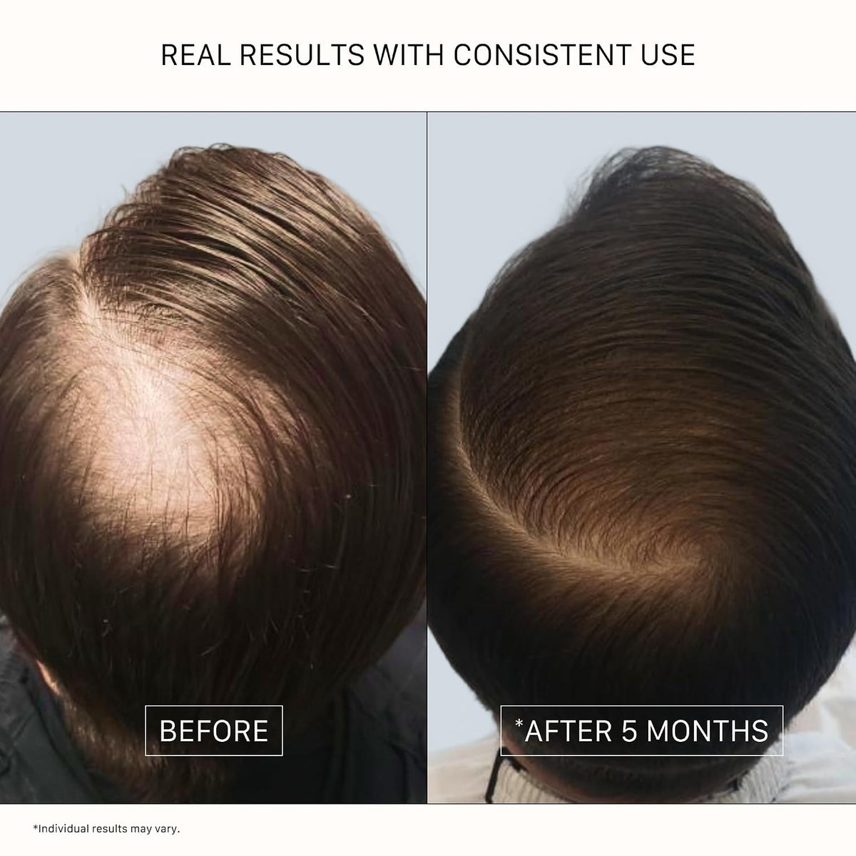 ACTIIV Recover Thickening Shampoo Treatment For Men | For Fuller Hair