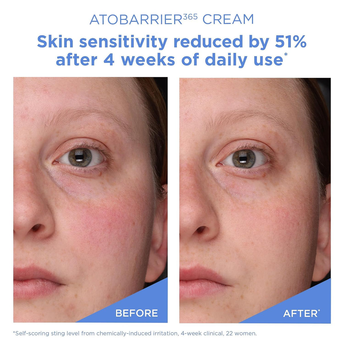 AESTURA ATOBARRIER365 Cream with Ceramides, 80 ML