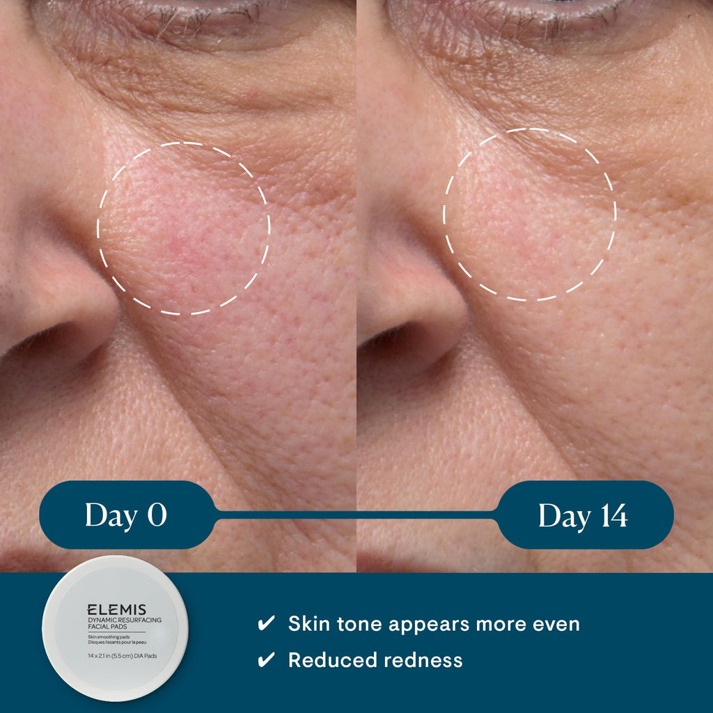 ELEMIS Dynamic Resurfacing Facial Pads, Gentle Textured Treatment